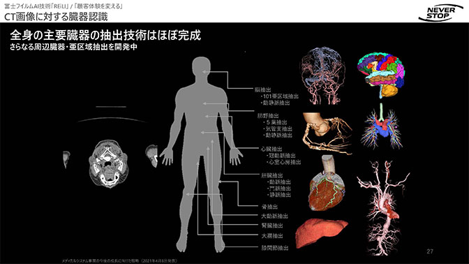 「CT 画像に対する臓器認識」を示すスライド