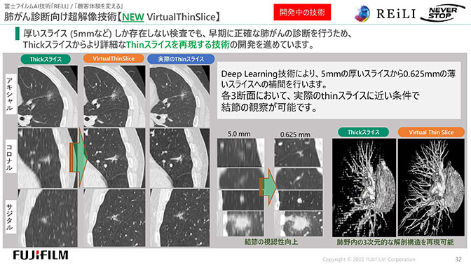 「肺がん診断向け超解像技術」を示すスライド